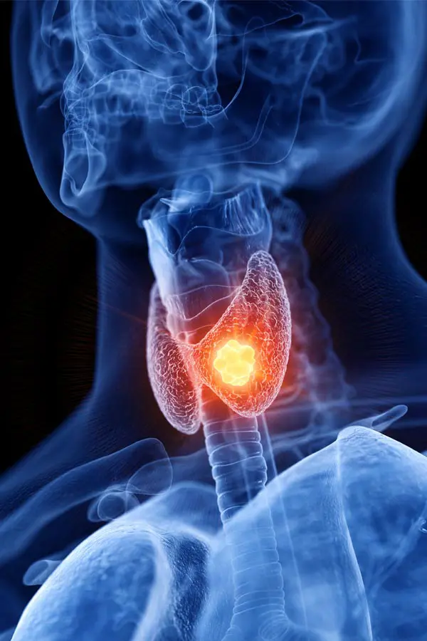 A 3D illustration of an x-ray of a human neck, highlighting the thyroid. Get help with thyroid imbalance in Miami with Vida Integrative Health of Miami.
